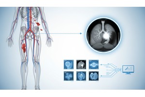 Can MRI See Blood Clots Understanding How Imaging Detects Vascular Problems - Created by PostDICOM